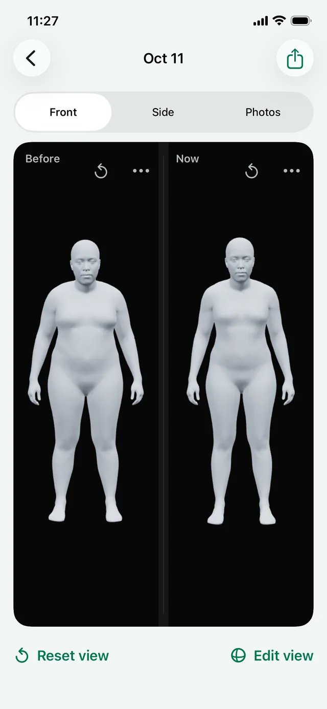 Front view of Before and Now 3D models of a fictional woman, side by side